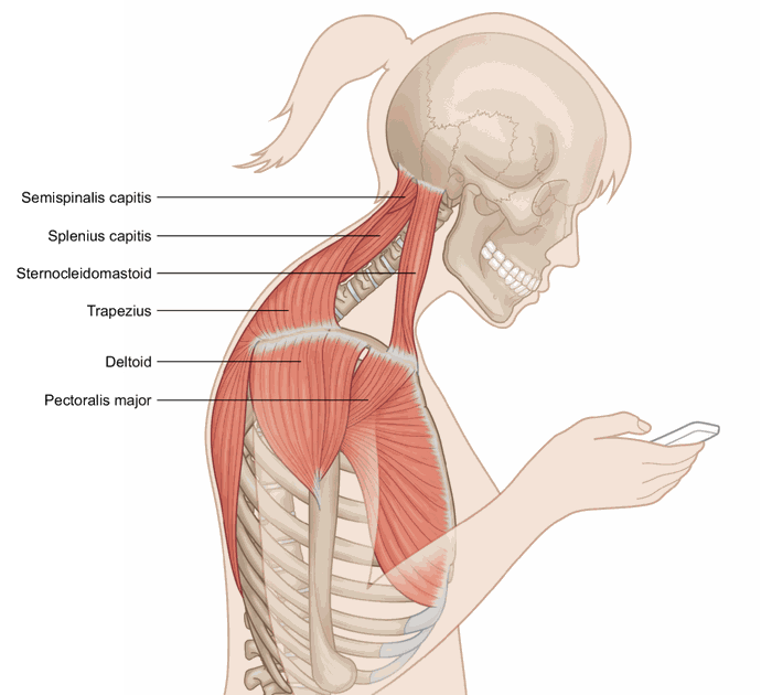 Trapezius houding
